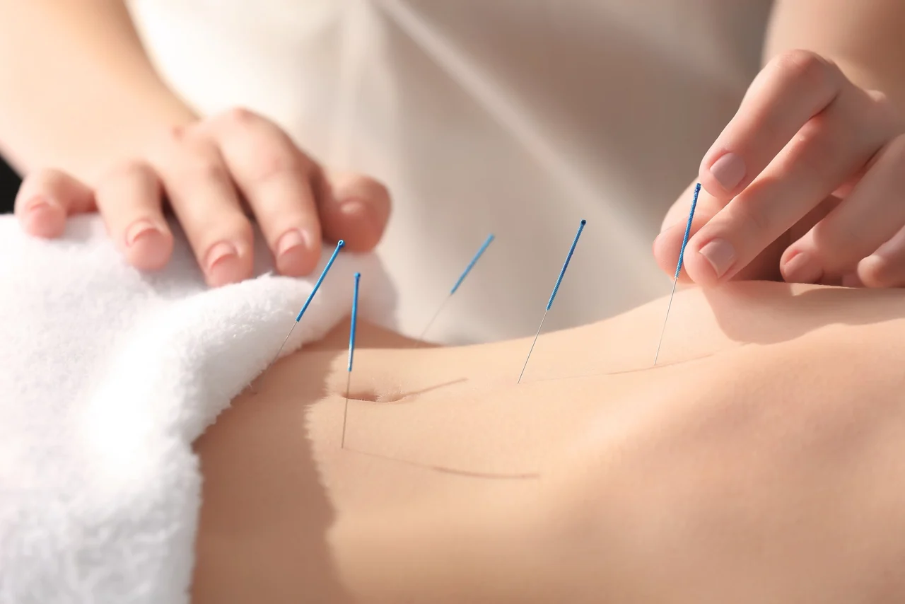Acupuncture treatment illustration from the original practice website